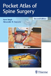 Cover Pocket Atlas of Spine Surgery
