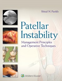 Cover Patellar Instability