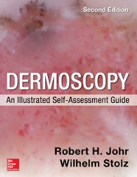 Cover Dermoscopy: An Illustrated Self-Assessment Guide, 2/e