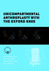 Cover Unicompartmental Arthroplasty with the Oxford Knee