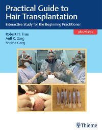 Cover Practical Guide to Hair Transplantation