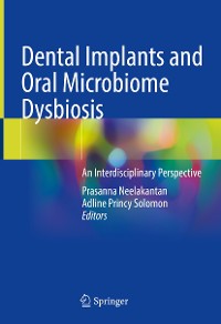 Cover Dental Implants and Oral Microbiome Dysbiosis