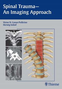 Cover Spinal Trauma - An Imaging Approach