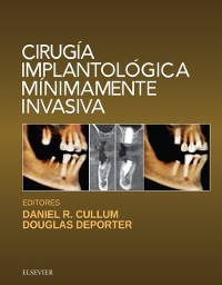 Cover Cirugía implantológica mínimamente invasiva