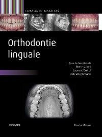 Cover Orthodontie linguale