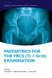 Cover Paediatrics for the FRCS (Tr + Orth) Examination