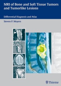 Cover MRI of Bone and Soft Tissue Tumors and Tumorlike Lesions