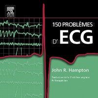 Cover 150 problèmes d''ECG