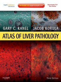 Cover Atlas of Liver Pathology E-Book