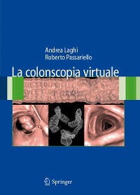 Cover La colonscopia virtuale