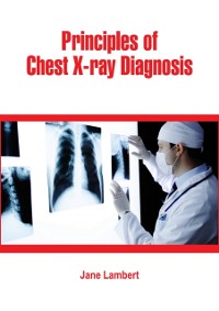 Cover Principles of Chest X-ray Diagnosis