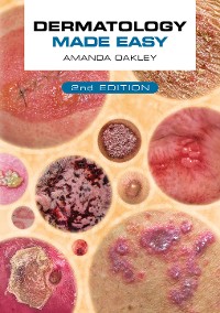 Cover Dermatology Made Easy, second edition