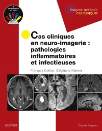 Cover Cas cliniques en neuro-imagerie : pathologies inflammatoires et infectieuses