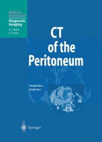 Cover CT of the Peritoneum