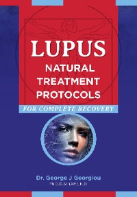 Cover Lupus