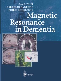 Cover Magnetic Resonance in Dementia