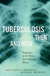 Cover Tuberculosis Then and Now