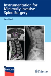Cover Instrumentation for Minimally Invasive Spine Surgery