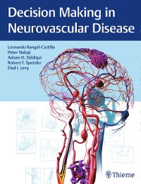 Cover Decision Making in Neurovascular Disease