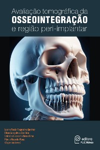 Cover Avaliação tomográfica da osseointegração e região peri-implantar