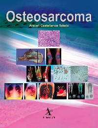 Cover Osteosarcoma