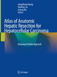 Cover Atlas of Anatomic Hepatic Resection for Hepatocellular Carcinoma