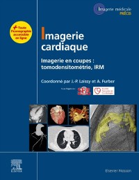 Cover Imagerie cardiaque