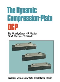 Cover Dynamic Compression Plate DCP