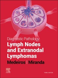 Cover Diagnostic Pathology: Lymph Nodes and Extranodal Lymphomas E-Book