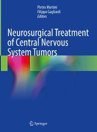 Cover Neurosurgical Treatment of Central Nervous System Tumors