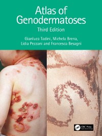 Cover Atlas of Genodermatoses