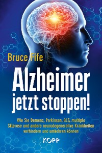 Cover Alzheimer jetzt stoppen!