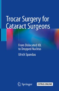 Cover Trocar Surgery for Cataract Surgeons