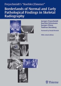Cover Freyschmidt's "Koehler/Zimmer" Borderlands of Normal and Early Pathological Findings in Skeletal Radiography