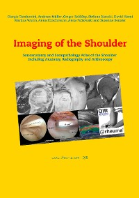 Cover Imaging of the Shoulder