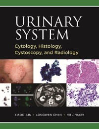 Cover Urinary System: Cytology, Histology, Cystoscopy, and Radiology