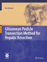 Cover Glissonean Pedicle Transection Method for Hepatic Resection