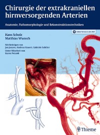 Cover Chirurgie der extrakraniellen hirnversorgenden Arterien