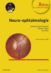 Cover Neuro-ophtalmologie