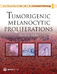 Cover Tumorigenic Melanocytic Proliferations