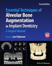 Cover Essential Techniques of Alveolar Bone Augmentation in Implant Dentistry