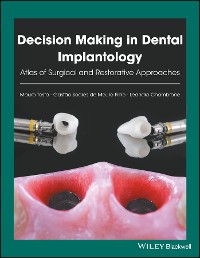 Cover Decision Making in Dental Implantology