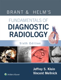 Cover Brant & Helm's Fundamentals of Diagnostic Radiology