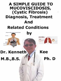 Cover Simple Guide To Mucoviscidosis (Cystic Fibrosis), Diagnosis, Treatment And Related Conditions