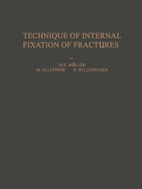 Cover Technique of Internal Fixation of Fractures