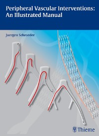 Cover Peripheral Vascular Interventions: An Illustrated Manual