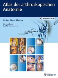 Cover Atlas der arthroskopischen Anatomie