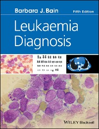Cover Leukaemia Diagnosis