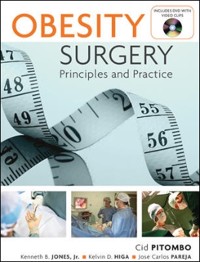 Cover Obesity Surgery: Principles and Practice