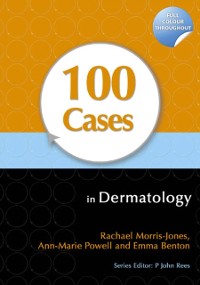 Cover 100 Cases in Dermatology